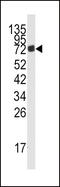 Adenosine Monophosphate Deaminase 3 antibody, 63-256, ProSci, Western Blot image 