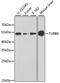 Tubulin Beta 8 Class VIII antibody, 23-553, ProSci, Western Blot image 