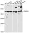 Transmembrane Protein 25 antibody, LS-C749374, Lifespan Biosciences, Western Blot image 