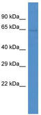 Zinc Finger Protein 284 antibody, TA343446, Origene, Western Blot image 