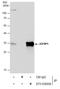 Insulin Like Growth Factor Binding Protein 1 antibody, GTX129006, GeneTex, Immunoprecipitation image 
