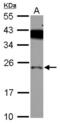 PRELI Domain Containing 1 antibody, NBP2-20015, Novus Biologicals, Western Blot image 