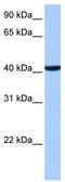 Coiled-Coil And C2 Domain Containing 1B antibody, TA340210, Origene, Western Blot image 