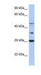 Pyruvate Dehydrogenase Kinase 3 antibody, NBP1-54707, Novus Biologicals, Western Blot image 