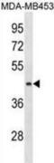 ALG8 Alpha-1,3-Glucosyltransferase antibody, abx030385, Abbexa, Western Blot image 