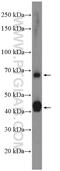 ATPase Na+/K+ Transporting Subunit Beta 2 antibody, 22338-1-AP, Proteintech Group, Western Blot image 