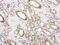 Gem Nuclear Organelle Associated Protein 8 antibody, LS-C796926, Lifespan Biosciences, Immunohistochemistry paraffin image 