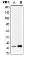 GTP-binding protein RAD antibody, MBS821944, MyBioSource, Western Blot image 