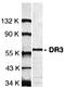 TNF Receptor Superfamily Member 25 antibody, orb74334, Biorbyt, Western Blot image 