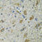 Thioredoxin, mitochondrial antibody, 22-482, ProSci, Immunohistochemistry paraffin image 