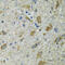 Thioredoxin 2 antibody, 22-482, ProSci, Immunohistochemistry paraffin image 