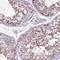 3-Oxoacid CoA-Transferase 1 antibody, NBP2-49331, Novus Biologicals, Immunohistochemistry paraffin image 