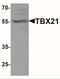 T-Box 21 antibody, NBP2-41235, Novus Biologicals, Western Blot image 