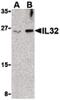 Interleukin 32 antibody, PA5-20222, Invitrogen Antibodies, Western Blot image 