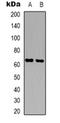 Copine 8 antibody, orb319009, Biorbyt, Western Blot image 