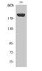 Insulin Receptor Substrate 1 antibody, STJ93775, St John