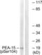 Proliferation And Apoptosis Adaptor Protein 15 antibody, LS-C199428, Lifespan Biosciences, Western Blot image 