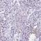 DMRT Like Family C2 antibody, HPA045016, Atlas Antibodies, Immunohistochemistry paraffin image 