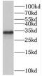 Survival Motor Neuron Domain Containing 1 antibody, FNab08035, FineTest, Western Blot image 