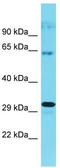 CWF19 Like Cell Cycle Control Factor 1 antibody, TA335522, Origene, Western Blot image 