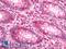Protein Arginine Methyltransferase 5 antibody, LS-B11683, Lifespan Biosciences, Immunohistochemistry frozen image 