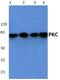 Protein Kinase C Alpha antibody, A00743T495, Boster Biological Technology, Western Blot image 