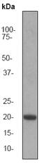 Colony Stimulating Factor 1 antibody, ab52864, Abcam, Western Blot image 