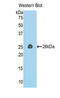 Coiled-Coil Domain Containing 80 antibody, LS-C293412, Lifespan Biosciences, Western Blot image 