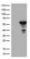Aldehyde Dehydrogenase 1 Family Member A3 antibody, TA502841, Origene, Western Blot image 
