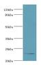 Apolipoprotein B MRNA Editing Enzyme Catalytic Subunit 3C antibody, LS-C380150, Lifespan Biosciences, Western Blot image 