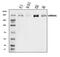 Vir Like M6A Methyltransferase Associated antibody, A32283-1, Boster Biological Technology, Western Blot image 