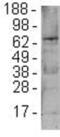 Forkhead Box P1 antibody, 14-9962-82, Invitrogen Antibodies, Western Blot image 