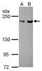 ERCC Excision Repair 5, Endonuclease antibody, GTX110609, GeneTex, Western Blot image 