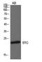 Betacellulin antibody, A02171, Boster Biological Technology, Western Blot image 