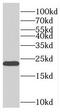 Phosphomevalonate Kinase antibody, FNab06580, FineTest, Western Blot image 