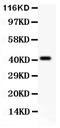 Ectodysplasin A antibody, LS-C344042, Lifespan Biosciences, Western Blot image 