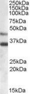 Arylsulfatase B antibody, NBP1-06021, Novus Biologicals, Western Blot image 