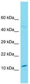 SNX20 antibody, TA333467, Origene, Western Blot image 