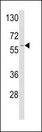 Plasminogen Activator, Tissue Type antibody, 62-457, ProSci, Western Blot image 