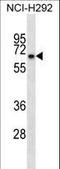 Kelch repeat and BTB domain-containing protein 10 antibody, LS-C165403, Lifespan Biosciences, Western Blot image 