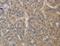 Dihydropyrimidinase Like 3 antibody, LS-C401613, Lifespan Biosciences, Immunohistochemistry paraffin image 