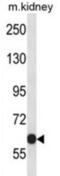 Potassium Voltage-Gated Channel Subfamily C Member 2 antibody, abx027658, Abbexa, Western Blot image 