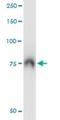 ATP Binding Cassette Subfamily F Member 2 antibody, H00010061-M01, Novus Biologicals, Immunoprecipitation image 