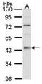 Hepatocyte Nuclear Factor 4 Alpha antibody, GTX100311, GeneTex, Western Blot image 