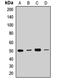DEAD-Box Helicase 47 antibody, LS-C668576, Lifespan Biosciences, Western Blot image 