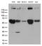 RNA Polymerase II Subunit A antibody, LS-C795245, Lifespan Biosciences, Western Blot image 