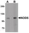 NLR Family Member X1 antibody, PA5-21018, Invitrogen Antibodies, Western Blot image 