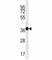 Mucin 15, Cell Surface Associated antibody, F42660-0.4ML, NSJ Bioreagents, Western Blot image 