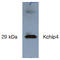 Potassium Voltage-Gated Channel Interacting Protein 4 antibody, AP26425AF-N, Origene, Western Blot image 