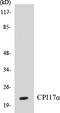 Protein Phosphatase 1 Regulatory Inhibitor Subunit 14A antibody, EKC1137, Boster Biological Technology, Western Blot image 